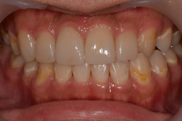 73bde1dca4952344964fff091cafa12a_1758088380_2703.jpg